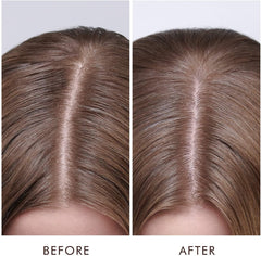 Moroccanoil Dry Scalp Treatment Kuru Saç Derisi Serumu 45ML