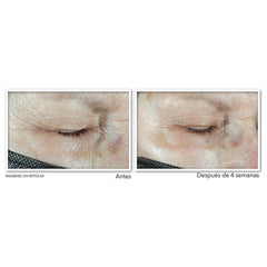 Roc Multi Correxion Hydrate Plump Göz Çevresi Kremi 15ML